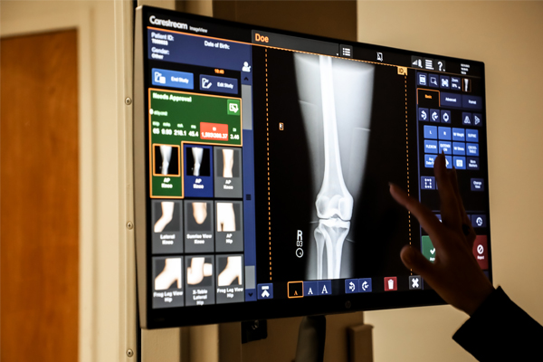 An x-ray diagram on a computer monitor