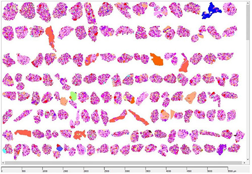 Particle and Grain Size Analysis by SEM